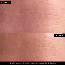 PHOTON LED Light Therapy Face Mask LED veido kaukė, 1vnt