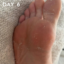 FOOT PEEL Professional Foot Treatment Peel-off Foot Mask-Socks, 1 pair