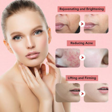 Riff M8807 Anti-aging / Rejuvenation device with 7 modes / 3 levels (3.7V / 4W / 750mAh) Riff M8807 Anti-aging / Rejuvenation device with 7 modes / 3 levels (3.7V / 4W / 750mAh)