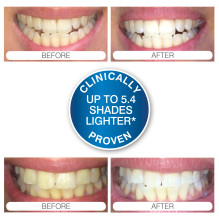 Rio DCWU-EU / 1,6 USB Teeth Whitening