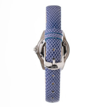 Laikrodis FOLLI FOLLIE WOMAN WF1A060STSADF (30MM) Laikrodis FOLLI FOLLIE WOMAN WF1A060STSADF (30MM)