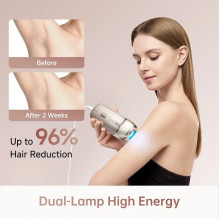 HAIR REMOVAL DEVICE IPL NOVA / AHR01-GOLD DREAME