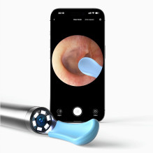 Otoskopas - Bebird EarSight R1 180 mAh Baltas